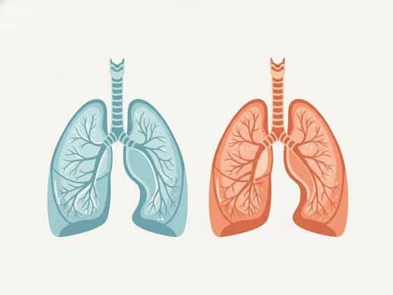 Medical illustration comparing healthy versus inflamed bronchial tubes in a lung cross-section.